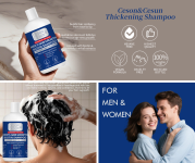 שמפו לגברים לעיבוי וחיזוק השיער מבית Ceson&Cesun הכולל ביוטין ב-14.5$ ליחידה או 2 ב־28.99$ עם משלוח חינם!