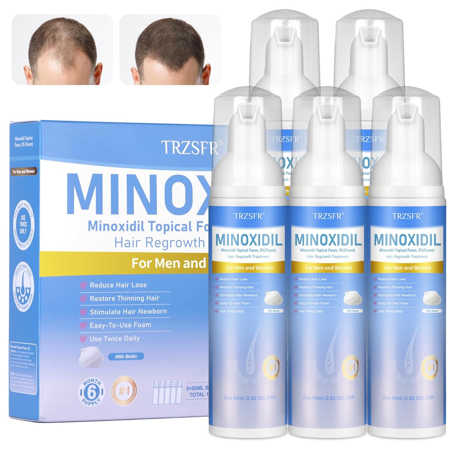 מארז ענק של קצף מינוקסידיל 5% Minoxidil Trzsfr לטיפול בנשירת שיער לגברים ונשים במחיר קופון אדיר! 71KN3xyexRL._SL1500_
