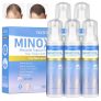 מארז ענק של קצף מינוקסידיל 5% Minoxidil Trzsfr לטיפול בנשירת שיער לגברים ונשים במחיר קופון אדיר!